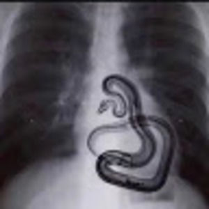 Meet your Posher, Dir by